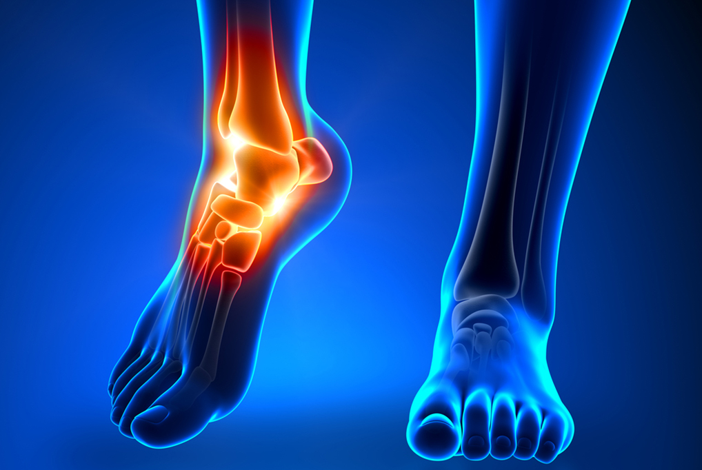 Foot & Ankle